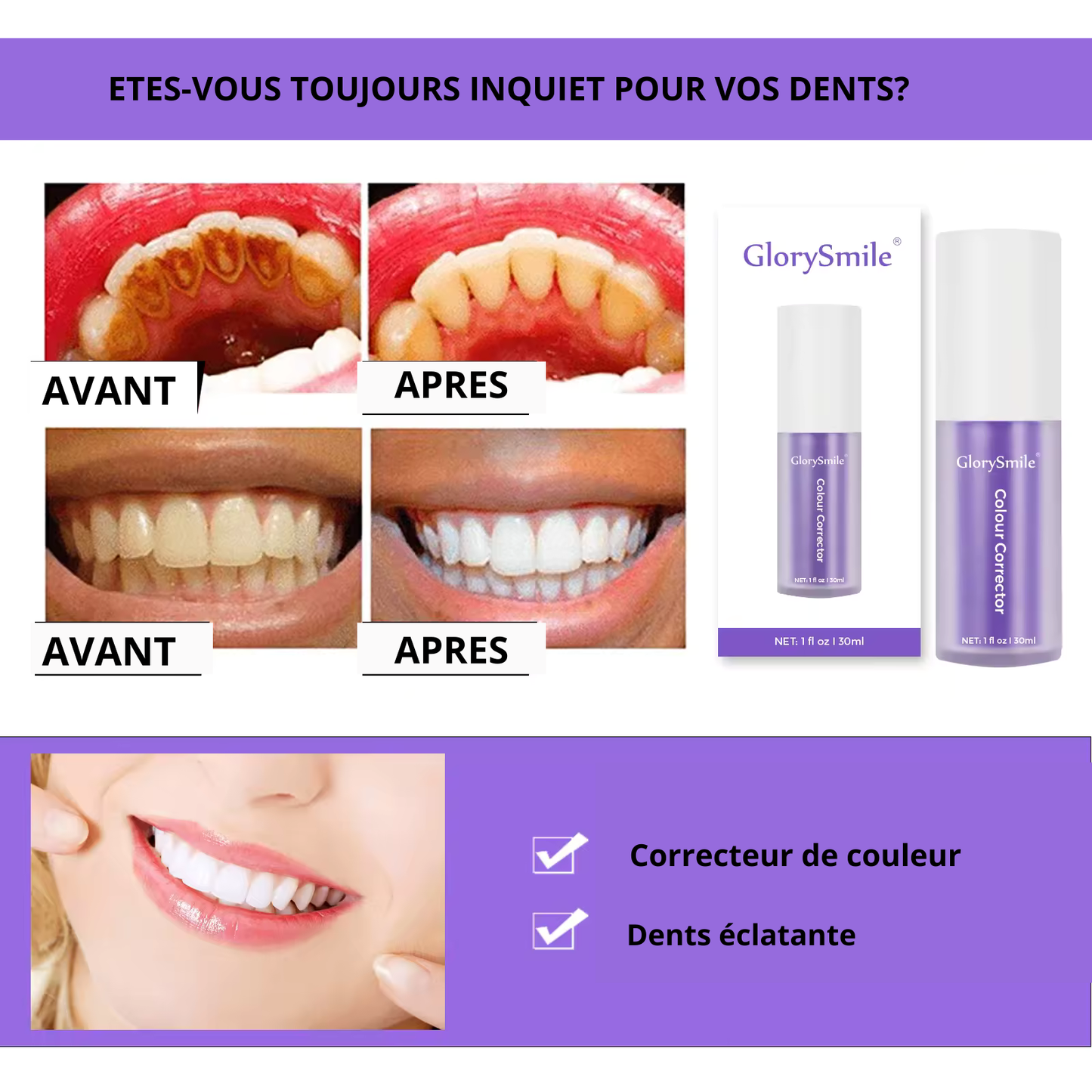 BLANCHISSEUR DENTAIRES WHITE SMILE V34