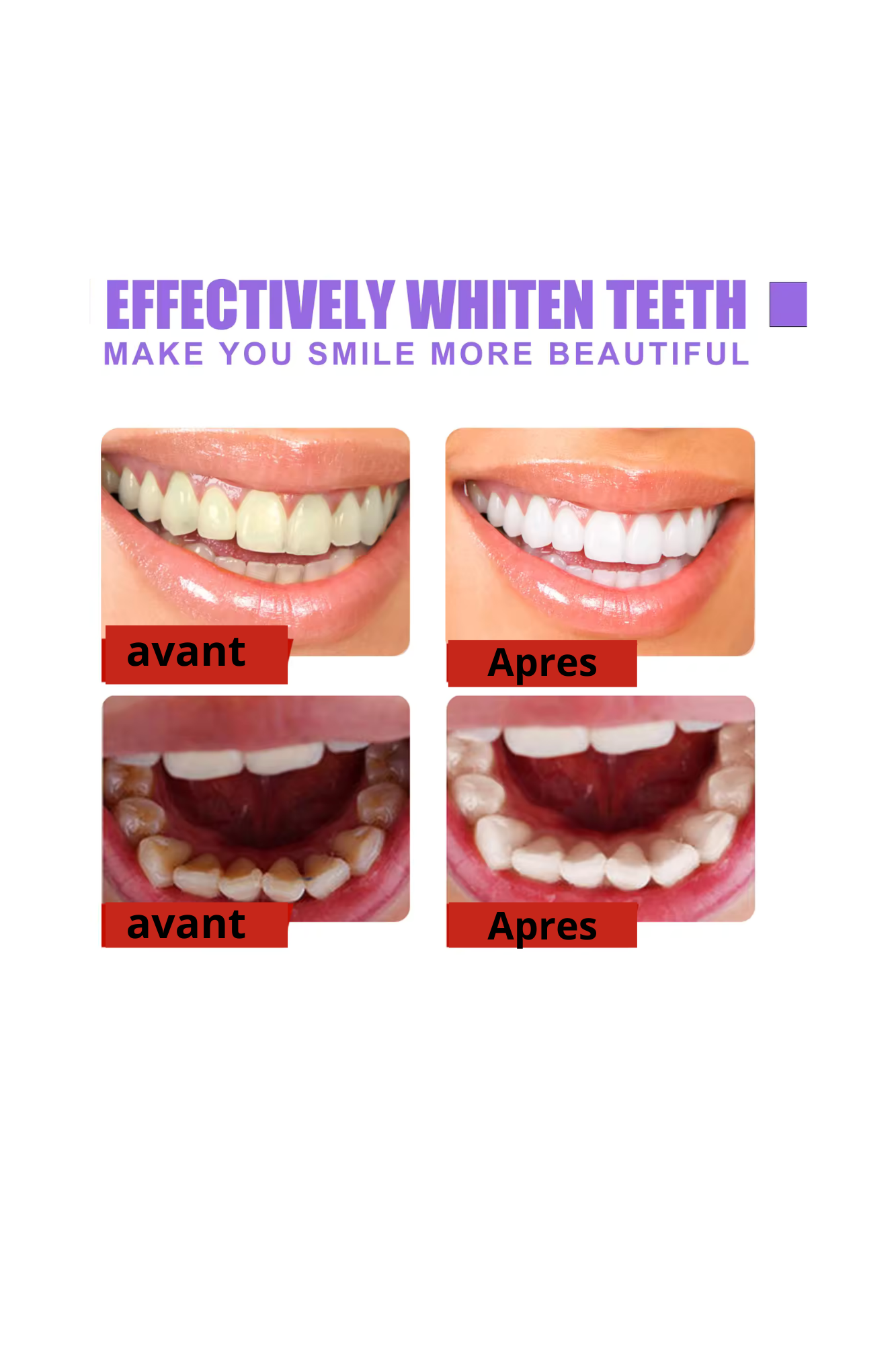 BLANCHISSEUR DENTAIRES WHITE SMILE V34